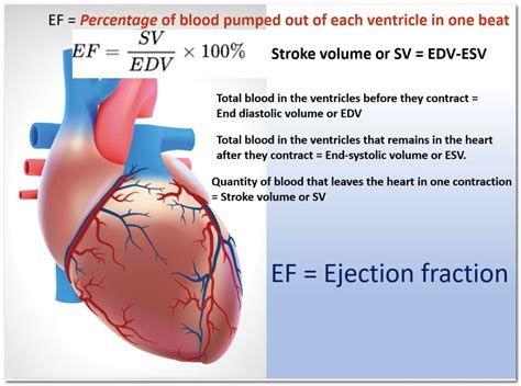 lvef and la conduit